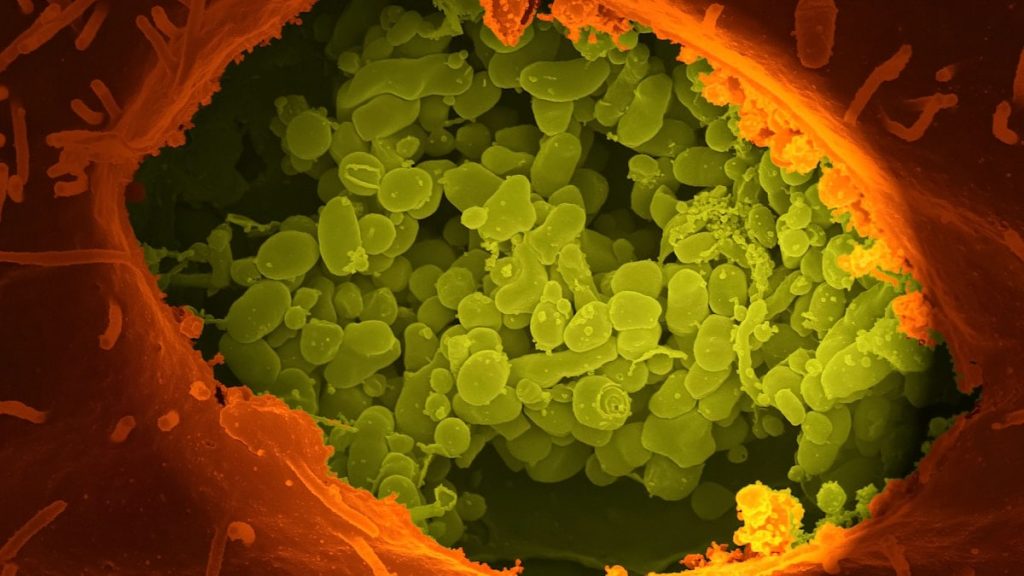 Coxiella burnetii - bacteria causing Q fever
