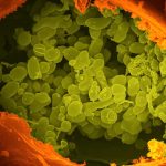 Alimenti che potenziano il sistema immunitario